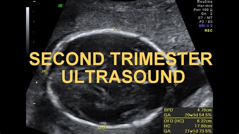 what is cas ultrasound|Sonography 2nd Trimester Assessment, Protocols, .